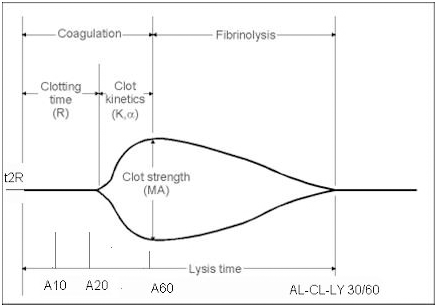 Parametri1